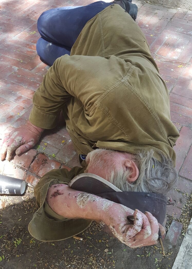 כבר שנים ברחוב ואיש אינו מושיע, זקוק בדחיפות לטיפול רופאי (צילום מתנדבים)